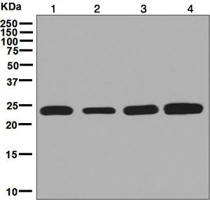 Western blot - Anti-RPE antibody [EPR7464] (AB128891)