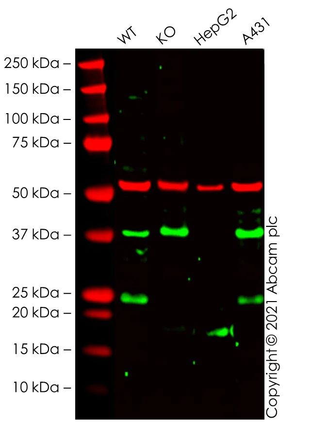Western blot - Anti-RPE antibody [EPR7464] (AB128891)