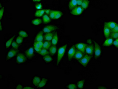 Immunocytochemistry/ Immunofluorescence - Anti-RPE65 antibody (AB235950)