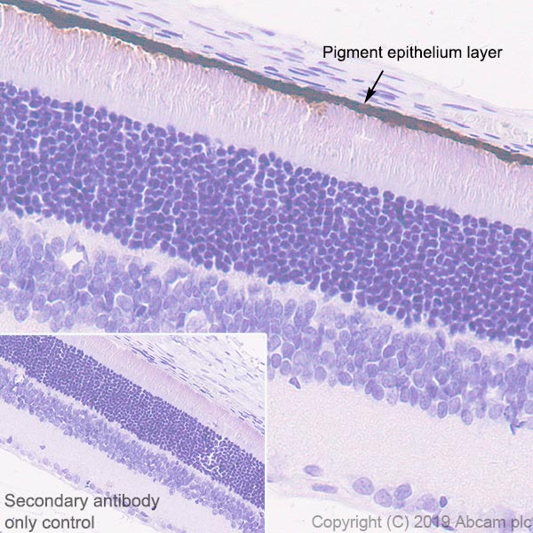 Immunohistochemistry (Formalin/PFA-fixed paraffin-embedded sections) - Anti-RPE65 antibody [EPR22579-44] (ab231782), expandable thumbnail