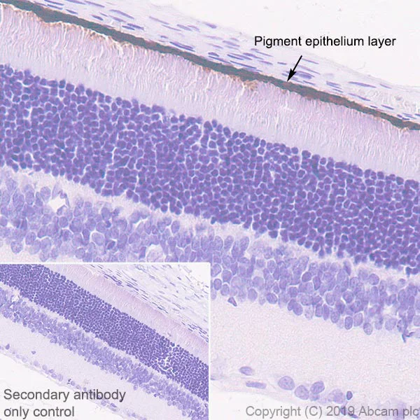 Immunohistochemistry (Formalin/PFA-fixed paraffin-embedded sections) - Anti-RPE65 antibody [EPR22579-44] (AB231782)