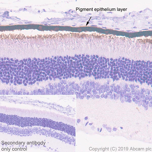 Immunohistochemistry (Formalin/PFA-fixed paraffin-embedded sections) - Anti-RPE65 antibody [EPR22579-44] (AB231782), expandable thumbnail