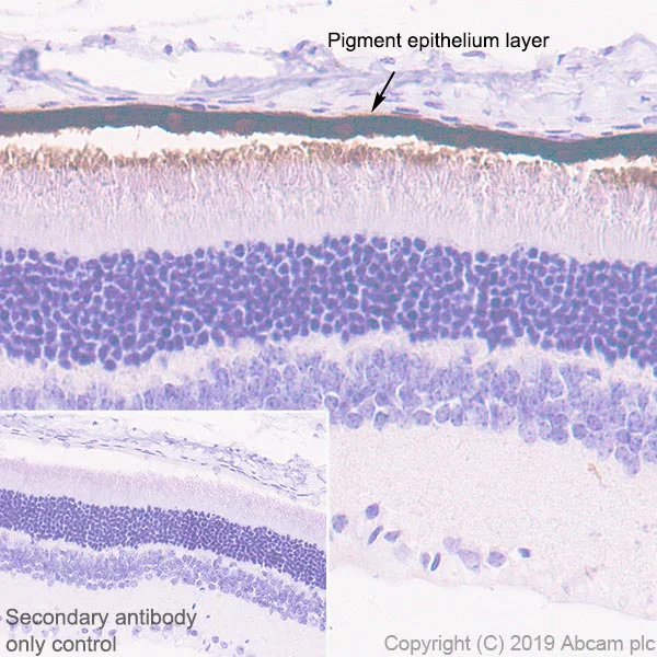Immunohistochemistry (Formalin/PFA-fixed paraffin-embedded sections) - Anti-RPE65 antibody [EPR22579-44] (AB231782)
