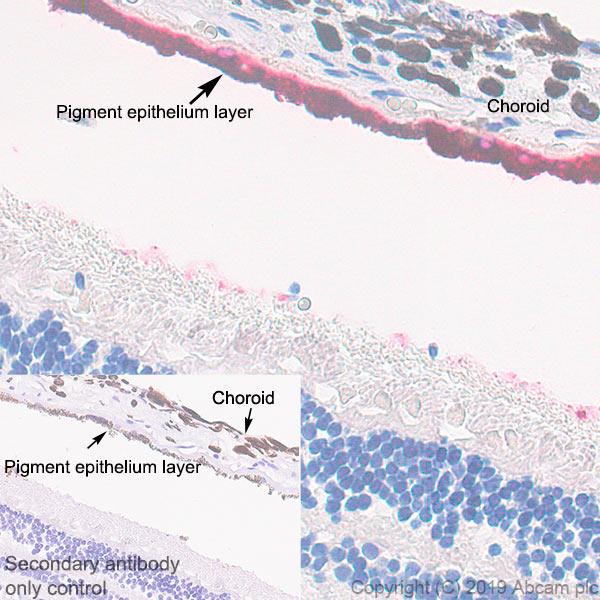 Immunohistochemistry (Formalin/PFA-fixed paraffin-embedded sections) - Anti-RPE65 antibody [EPR22579-44] (AB231782), expandable thumbnail
