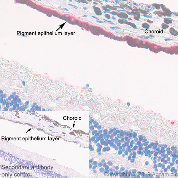 Immunohistochemistry (Formalin/PFA-fixed paraffin-embedded sections) - Anti-RPE65 antibody [EPR22579-44] (AB231782)