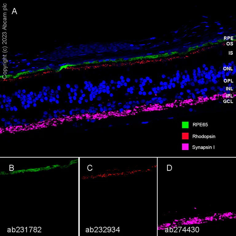 Multiplex immunohistochemistry - Anti-RPE65 antibody [EPR22579-44] (AB231782)