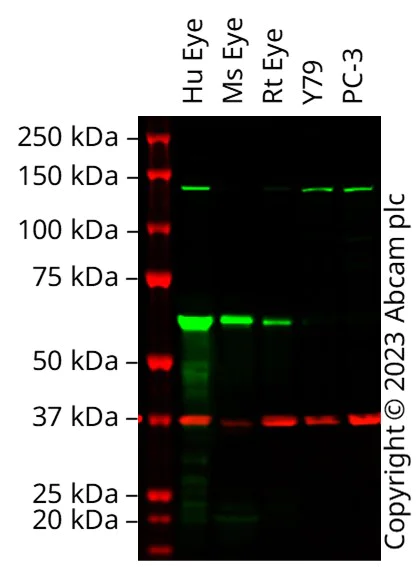 Western blot - Anti-RPE65 antibody [EPR22579-44] (AB231782)