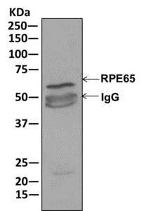 Immunoprecipitation - Anti-RPE65 antibody [EPR7024(N)] - BSA and Azide free (AB249901)