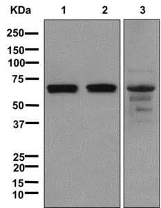 Western blot - Anti-RPE65 antibody [EPR7024(N)] - BSA and Azide free (AB249901)