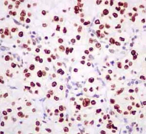 Immunohistochemistry (Formalin/PFA-fixed paraffin-embedded sections) - Anti-RPF2 antibody [EP10252] (AB180604)