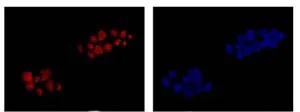 Immunocytochemistry/ Immunofluorescence - Anti-RPF2 antibody [EP10252] - BSA and Azide free (AB284831)