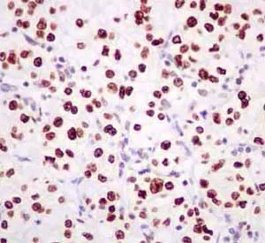 Immunohistochemistry (Formalin/PFA-fixed paraffin-embedded sections) - Anti-RPF2 antibody [EP10252] - BSA and Azide free (AB284831)