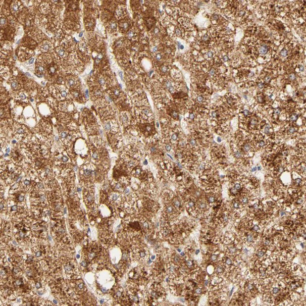 Immunohistochemistry (Formalin/PFA-fixed paraffin-embedded sections) - Anti-RPGR antibody (AB121143)