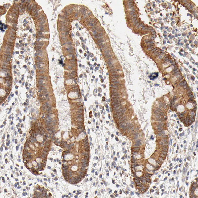 Immunohistochemistry (Formalin/PFA-fixed paraffin-embedded sections) - Anti-RPGR antibody (AB121143)