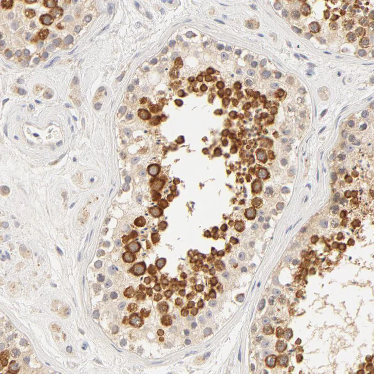 Immunohistochemistry (Formalin/PFA-fixed paraffin-embedded sections) - Anti-RPGR antibody (AB121143)