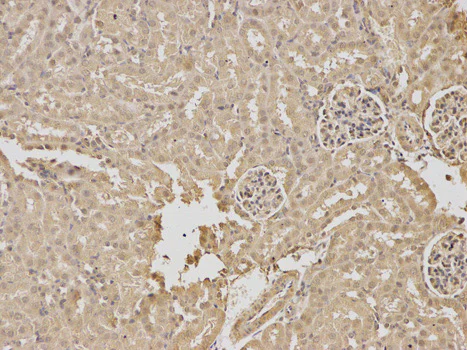 Immunohistochemistry (Formalin/PFA-fixed paraffin-embedded sections) - Anti-RPGR antibody - N-terminal (AB180729)