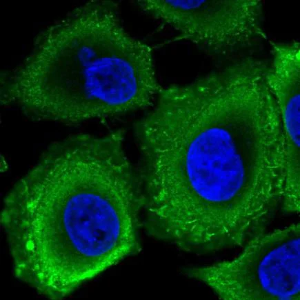Immunocytochemistry/ Immunofluorescence - Anti-RPGRIP1L/FTM antibody (AB220254)