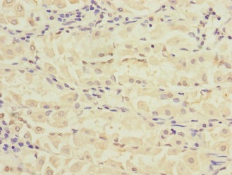 Immunohistochemistry (Formalin/PFA-fixed paraffin-embedded sections) - Anti-RPIA/PRI antibody (AB229967)