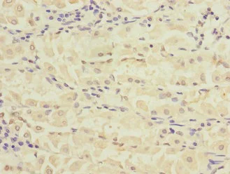 Immunohistochemistry (Formalin/PFA-fixed paraffin-embedded sections) - Anti-RPIA/PRI antibody (AB229967)