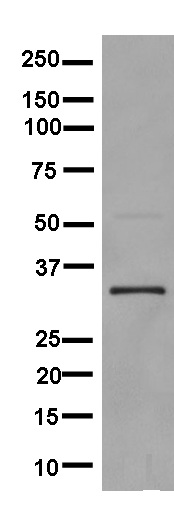 Western blot - Anti-RPIA/PRI antibody [EPR12961] (AB181235)