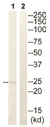 Western blot - Anti-RPL10 antibody (AB110371)