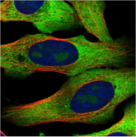Immunocytochemistry/ Immunofluorescence - Anti-RPL10A antibody (AB187998)
