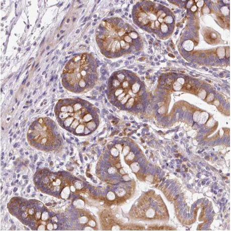 Immunohistochemistry (Formalin/PFA-fixed paraffin-embedded sections) - Anti-RPL10A antibody (AB187998)