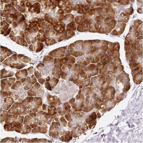 Immunohistochemistry (Formalin/PFA-fixed paraffin-embedded sections) - Anti-RPL10A antibody (AB187998)