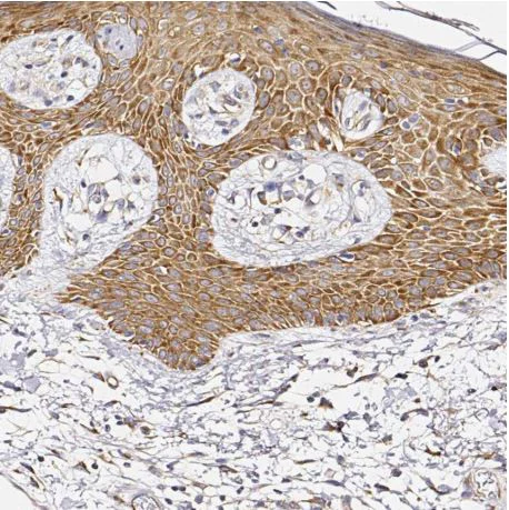 Immunohistochemistry (Formalin/PFA-fixed paraffin-embedded sections) - Anti-RPL10A antibody (AB187998)
