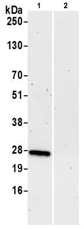 Immunoprecipitation - Anti-RPL10A antibody (AB226381)