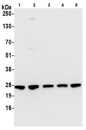 Western blot - Anti-RPL10A antibody (AB226381)