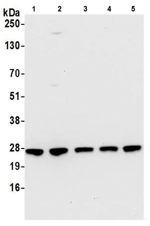 Western blot - Anti-RPL10A antibody (AB226381)