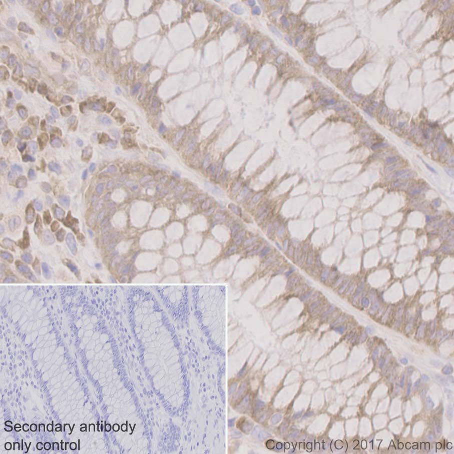 Immunohistochemistry (Formalin/PFA-fixed paraffin-embedded sections) - Anti-RPL10A antibody [EPR12344] (ab174318), expandable thumbnail