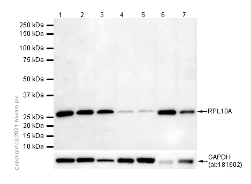 Western blot - Anti-RPL10A antibody [EPR12344] (AB174318), expandable thumbnail
