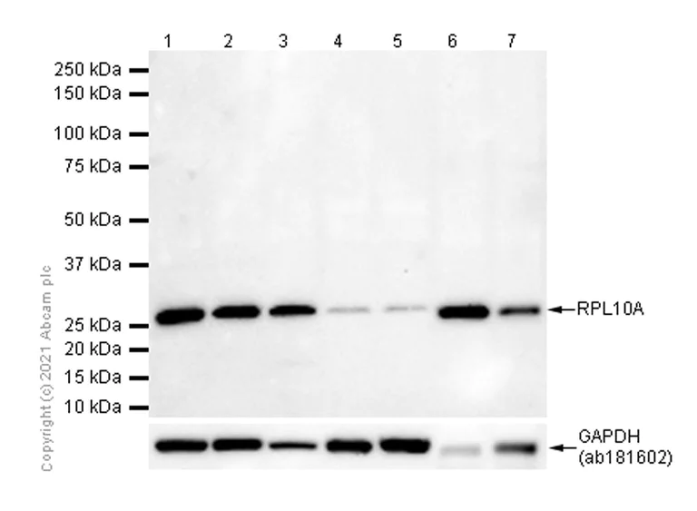 Western blot - Anti-RPL10A antibody [EPR12344] - BSA and Azide free (AB240179)