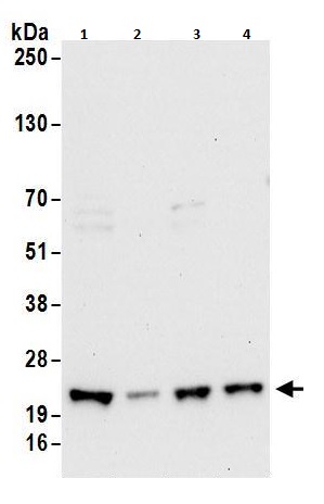 Western blot - Anti-RPL11 antibody (AB264342)