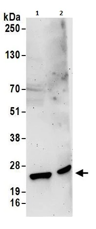 Western blot - Anti-RPL11 antibody (AB264342)
