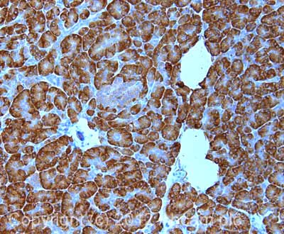 Immunohistochemistry (Formalin/PFA-fixed paraffin-embedded sections) - Anti-RPL11 antibody (AB79352)