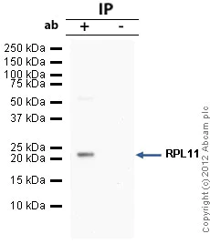 Immunoprecipitation - Anti-RPL11 antibody (AB79352)