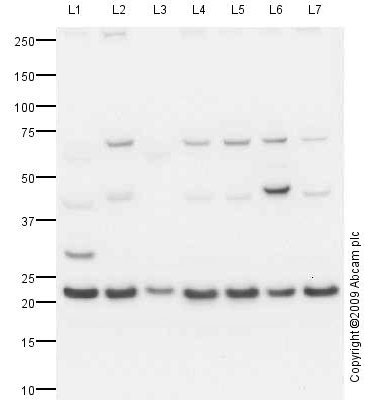Western blot - Anti-RPL11 antibody (AB79352)