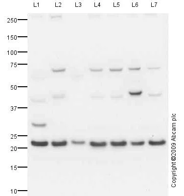 Western blot - Anti-RPL11 antibody (AB79352)