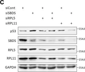 Western blot - Anti-RPL11 antibody (AB79352)