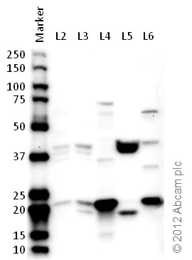 Western blot - Anti-RPL11 antibody (AB79352)