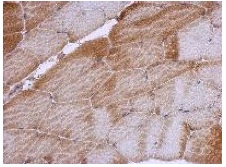 Immunohistochemistry (Formalin/PFA-fixed paraffin-embedded sections) - Anti-RPL12 antibody (AB127533), expandable thumbnail