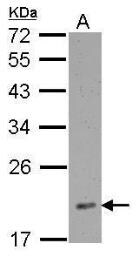 Western blot - Anti-RPL12 antibody (AB127533), expandable thumbnail