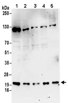 Western blot - Anti-RPL12 antibody (AB157130)