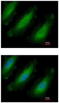 Immunocytochemistry/ Immunofluorescence - Anti-RPL13A antibody (AB96074)