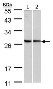 Western blot - Anti-RPL13A antibody (AB96074)
