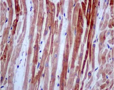 Immunohistochemistry (Formalin/PFA-fixed paraffin-embedded sections) - Anti-RPL14 antibody [EPR12301] (AB181200)