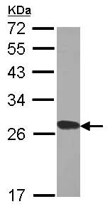 Western blot - Anti-RPL15/L10 antibody (AB155802)